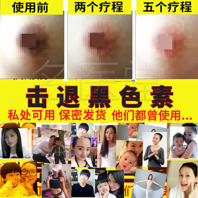 私处粉嫩外阴嫩红素淡化乳头乳晕臀部私密处腋下大腿根脸去黑色素