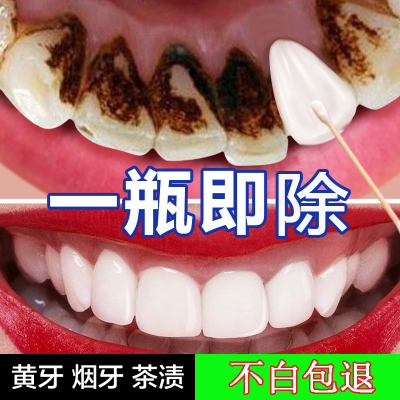 牙齿美白速效神器去黄牙烟渍牙渍牙结石男女牙贴泰国洗牙粉小苏打
