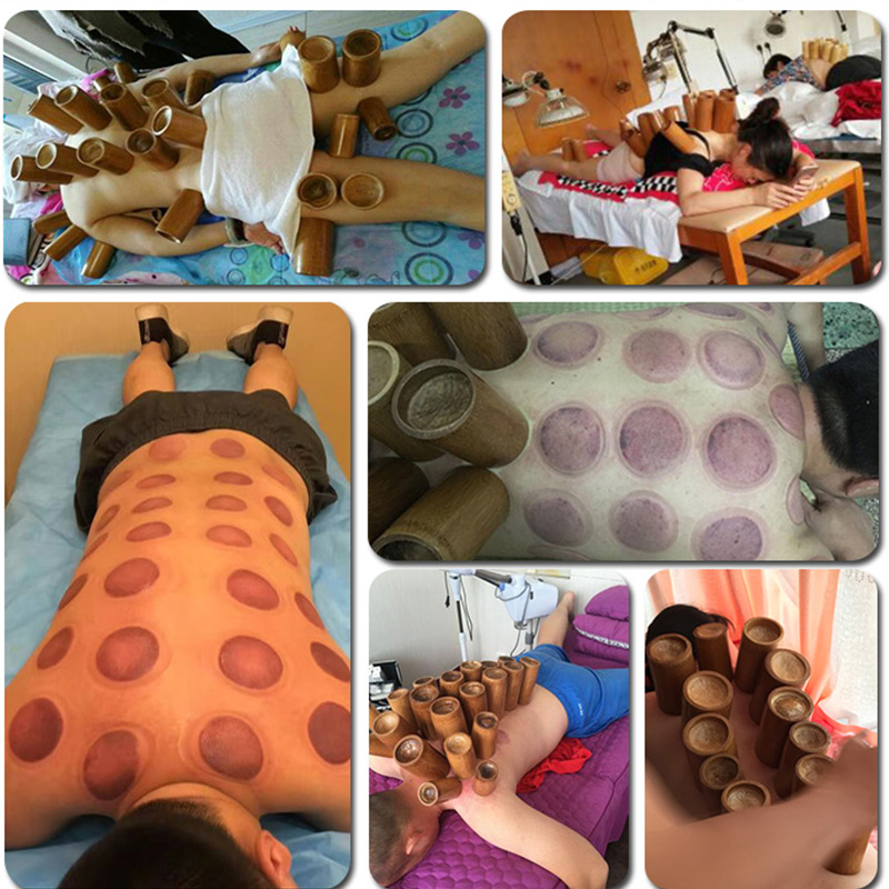 carbonized bamboo bamboo bamboo cupping jar MuZhu syringes hygroscopic cans full bamboo medium home kit number