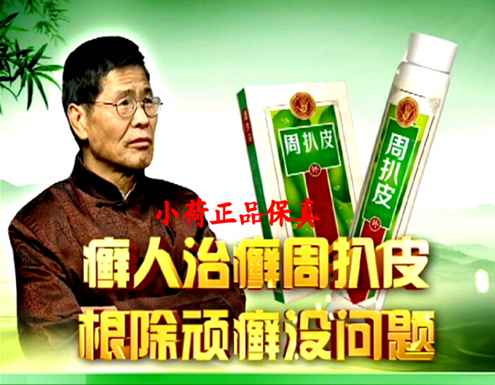 周扒皮清癣膏效果怎么样多少钱一盒