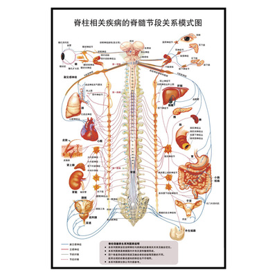 医疗脊柱按摩挂图挂画《脊柱相关疾病的脊髓节
