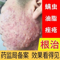 Очищающее молочко для лица подходит для мужчин и женщин, глубокое очищение, контроль жирного блеска, анти-акне