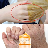 Mặt Nạ tay Tear-loại Làm Trắng Giữ Ẩm Tẩy Tế Bào Chết Lột Rough Chăm Sóc Tay Chăm Sóc Hand Wax Mặt Nạ Tay dưỡng ẩm da tay