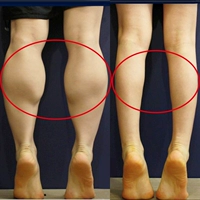 Нога 10 коробок для армированной упаковки [похудение 8-12 кот]]