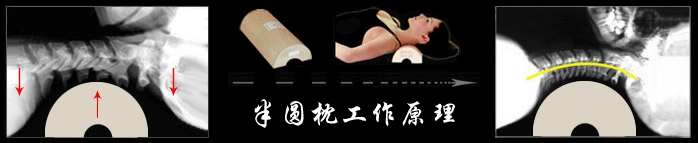 Gỗ vui vẻ phần ngắn sửa chữa cổ tử cung gối chăm sóc sức khỏe cổ gối gối massage máy kéo bán nguyệt log gối gối chống trào ngược monmon