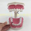 2 times large teeth (disassembly of the lower teeth)