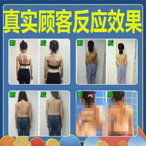 Корректор осанки, наплечники для пожилых людей, ортезы, коррекция спины