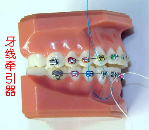 Купить 2 Дайте 1 Love Dental Dental Dental Direction Line Line Orthodontic Container Curret