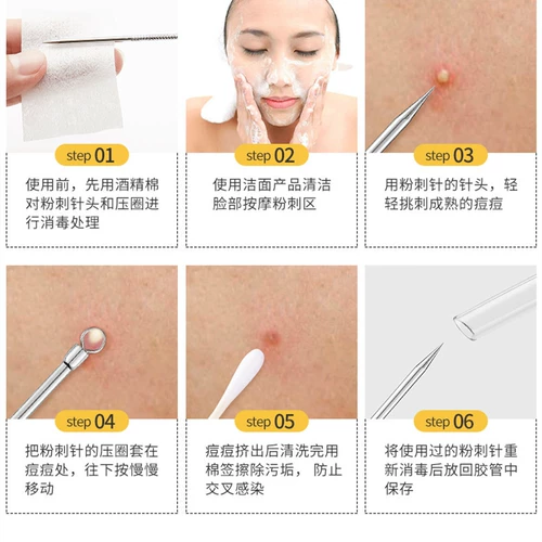 Косметический пинцет от черных точек, анти-акне, скрывает прыщи, для салонов красоты