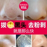 Средство для удаления прыщей, освежающая лечебная маска для лица от черных точек, глубокое очищение, контроль жирного блеска, T-зона