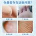 Mặt nạ tẩy tế bào chết Xue Ling Fei Rose Mặt nạ dưỡng ẩm mềm mịn Mặt nạ dưỡng ẩm tẩy da chai cứng ở gót chân Trị liệu chân
