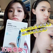 Lin Yun khuyên dùng Hàn Quốc Wonjin Yuanchen Yuanchen Hyaluronic Acid Hyaluronic Acid Ampoule Mặt nạ dưỡng ẩm làm mới