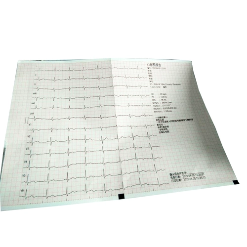 Zhongqi 12-й сердечный электрический рисунок 210*140-20M Эта форма 210x140-20 Термиста-чувствительная бумага для бумаги