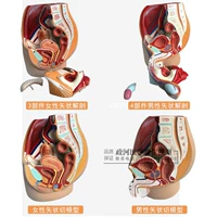 Подлинная мужская репродуктивная мочевая модель модель мужской анатомии модели анатомии модели простаты бесплатная доставка
