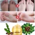 [Đặc biệt hàng ngày] Po Quan Ya chân phim để da chết cũ da lột chống khô chăm sóc bàn chân giữ ẩm chính hãng