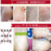 芷茜 lột chân phim tẩy tế bào chết sừng cũ đấu thầu dịu dàng chân đẹp chân da lộn bộ phim chân bộ chăm sóc bàn chân chân dán mặt nạ chân Trị liệu chân
